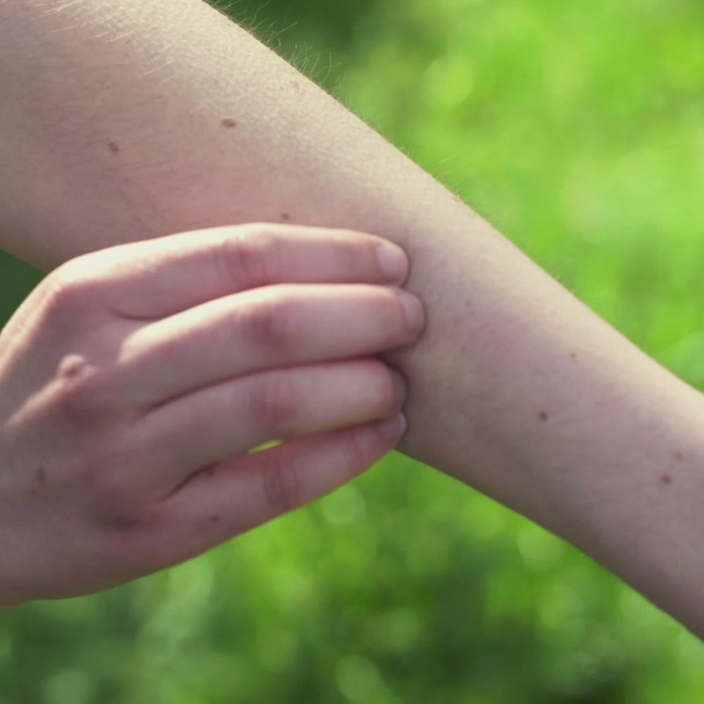 heat it® Insect bite healer